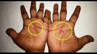 Only 3% Of People Have The Letter X On Their Both Hands  Here&rsquo;s What It Means About Your Destiny!