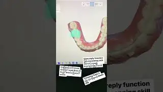 Medit - Trimming & Scan Replay