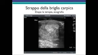 Strappo tendineo in un cavallo da sella