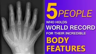 5 People who holds World Record for unique Physical features | factOreal