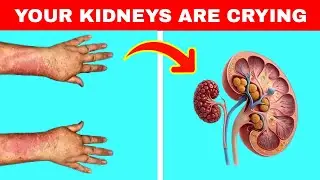 Top 10 Warning Signs That Your Kidneys are Toxic