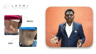 Laxmi Vitiligo Centre Intro Video