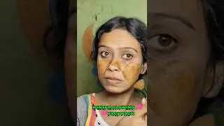 শীতে ভোকম ভোকম Glowing Skin ✨❄️ | Winter Skin Care | #Shorts #viral