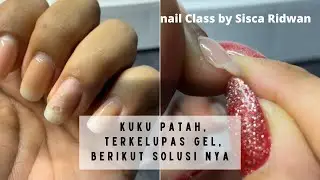 Memperbaiki Kuku Gel yang Patah, Serta Terkelupas. Agar tidak merusak Kuku asli #gelnail #brokennail