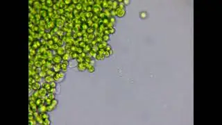 Potential Filasteria, Kraken, or other Cercozoa - Pt. 1