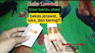 Bio Oil untuk Bekas Jerawat & Luka &mdash; Hasilnya Mengejutkan!
