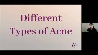 Treating acne with BiON