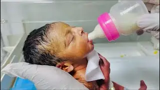 First Bottle Feeding for Low Birth Weight Baby | NICU Baby Care Moments👨&zwj;🍼💖