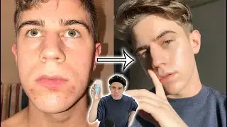 an actual skincare video omg lol