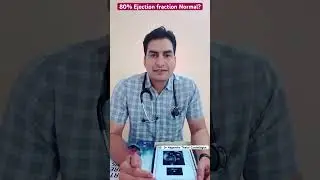 Echo में 70%,80% EF के क्या कारण है l #echo #ef #shorts