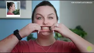 How To Take Photos Of Your Teeth At Home