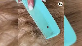 Why Pet Parents Love Tick Free Combo | Tick Free Spray | Tick Free Shampoo | Tick Repellent Spray 
