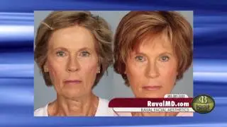 Dr. Raval on the Art of Facial Plastic Surgery