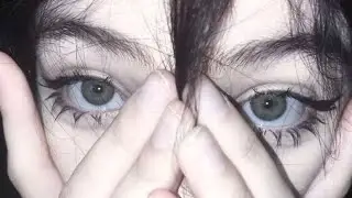 EYE BAGS WHO? $3000 under EYE FILLER look but FREE.
