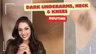 Treatment for Dark Underarms, Dark Neck, and Body Pigmentation | Nipun Kapur