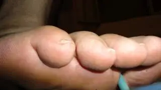 Slideshow n.3 - My EXTREMELY DIRTY baresoles!!!!!!!