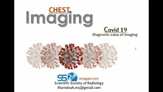 Chest imaging Covid 19 diagnostic value of imaging - Prof  Mamdouh Mahfouz6