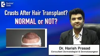 Hair Transplant Crusts Day 1 to Day 14 | Complete Healing Guide - Dr. Harish  | Doctors' Circle