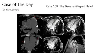 Case of the Day - 168 - The Banana Shaped Heart
