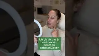 Gesprach mit Patientin nach Behandlung in Monof&auml;den f&uuml;r Kinn/Jawline! Erkl&auml;rt &Auml;rztin Kathrin Friebus