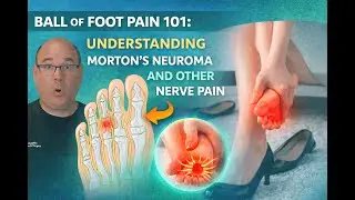 Ball of Foot Pain 101: Understanding Morton's Neuroma and Other Nerve Pain