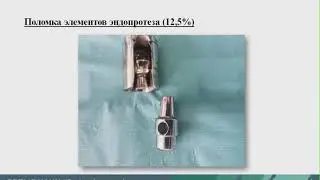 Reasons for revision arthroplasty in cancer patients (Aleksey Starodubtsev)