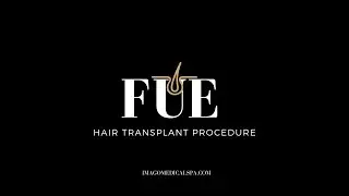 FUE Permanent Hair Transplant Process