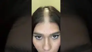 Razor headshave right in the middle of head!