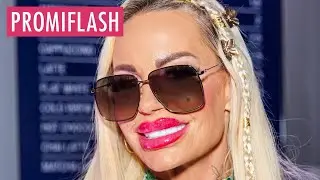 Gina-Lisa Lohfink zeigt Folgen der verpfuschten Po-Operation