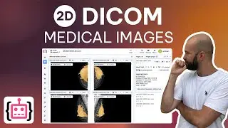 2D Medical Images in Supervisely: How to Annotate DICOM Mammograms