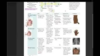 Upper Limb Nerve Injuries and Arm Abduction- Klumpke's Palsy, TOS and Winged Scapula