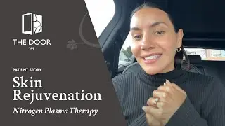 Nitrogen Plasma Therapy by AgeJet testimonial with Before & Afters | Dr Julia Coelho at The Door W4