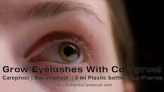 How To Use Careprost Eye Drops  |Buy Authentic Careprost | #careprost
