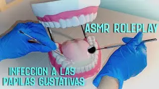 ASMR MAGA | INFECCION A LAS PAPILAS GUSTATIVAS