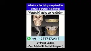 Things required for Virtual Surgical Planning | Corrective Jaw Surgery | Dr Parit Ladani