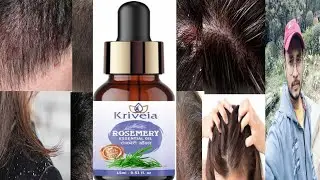 Kriveia Rosemary Essential Oil Review In Hindi