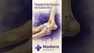 UCL Reconstruction (Tommy John Surgery)
