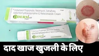 D drem kt cream use in hindi | #ketoconazole neomycine clobetasole tolnafate iodochloro | दाद खाज