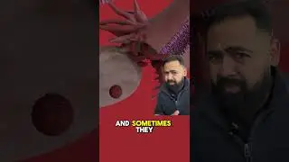 Doctor Explains Ectopic Pregnancy Glitch!