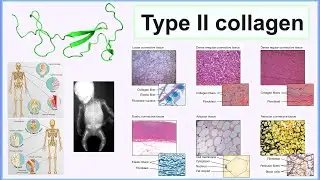 type II collagen