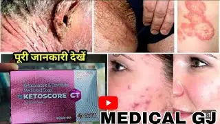 ketoscor ct soap | ketoscor ct cream | ketconazole soap  | खुजली का साबुन | Fourfight skin cream
