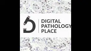 158: Multimodal Magic AI&rsquo;s Role in Lung & Prostate Cancer Predictions