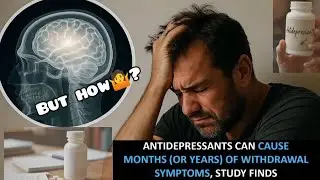 Antidepressant Withdrawal Can Last YEARS &mdash; New Shocking Study Reveals!