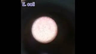 Escherichia coli gram stain Microbiology Bacteriology Ecoli