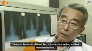 Fukushima Worker says ERROR on Dosimeter from HIGH RADIOACTIVITY in Unit 1 Update 10/12/11