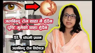 जलबिन्दु रोग के हो (Glaucoma) Dr Chandni Pradhan Glaucoma Specialist