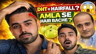 DHT vs AMLA: Baal Jhadna Bilkul Band! 🛑 Stop Hair Loss Naturally