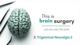 This is Brain Surgery 2: Trigeminal Neuralgia Part 2