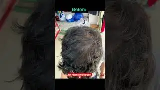 Mars By GHC 4 Months Final Review | Redensyl Hair Vitalizer | Redensyl Hair Before After Photos