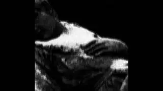 Natures Mortes - Bruises